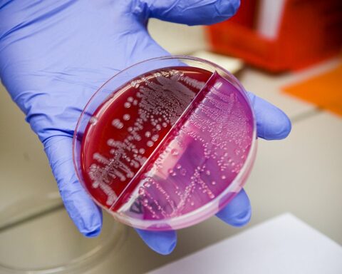 Lab Sample Bacteria Disease