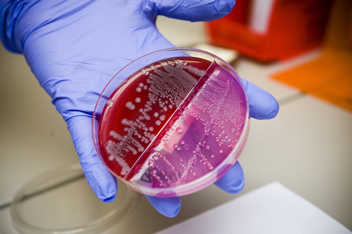 Lab Sample Bacteria Disease